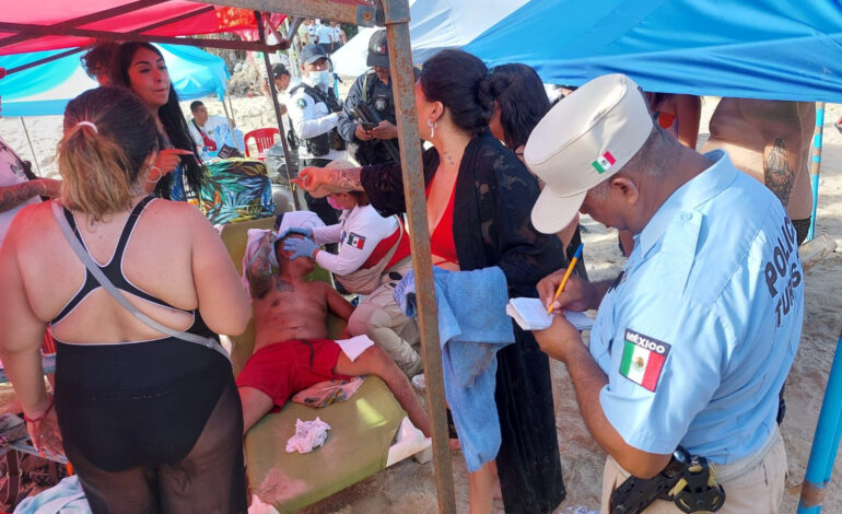 Asaltan y balean a turista cerca de un hotel de la avenida Costera de Acapulco